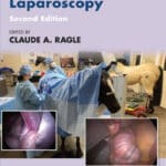Advances in Equine Laparoscopy, 2nd Edition