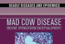 Mad Cow Disease Bovine Spongiform Encephalopathy