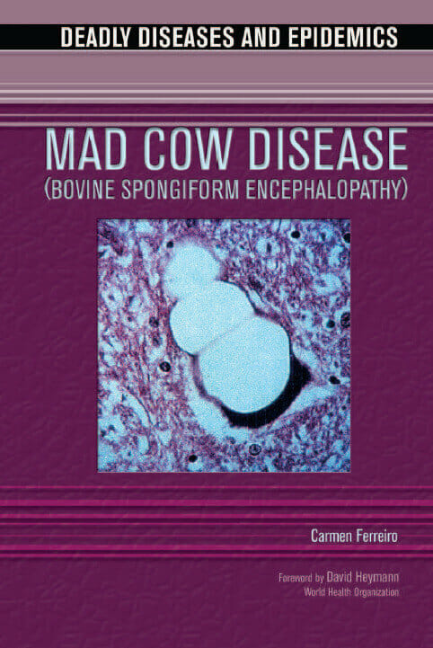 Mad Cow Disease Bovine Spongiform Encephalopathy