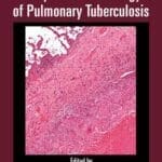a-color-atlas-of-comparative-pathology-of-pulmonary-tuberculosis