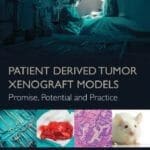 patient-derived-tumor-xenograft-models-promise-potential-and-practice