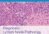 Download Diagnostic Lymph Node Pathology 3rd Edition PDF