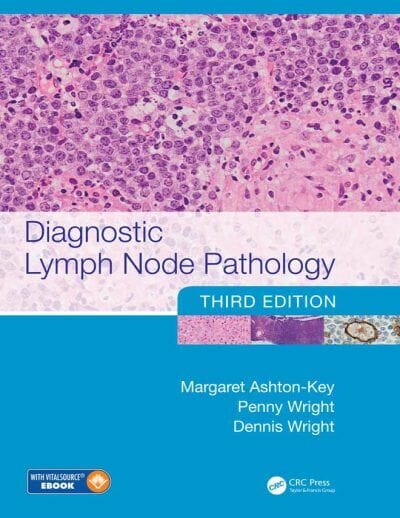 Diagnostic Lymph Node Pathology, 3rd Edition