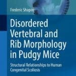 Disordered Vertebral and Rib Morphology in Pudgy Mice: Structural Relationships to Human Congenital Scoliosis