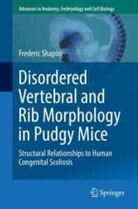 Disordered Vertebral And Rib Morphology In Pudgy Mice: Structural Relationships To Human Congenital Scoliosis