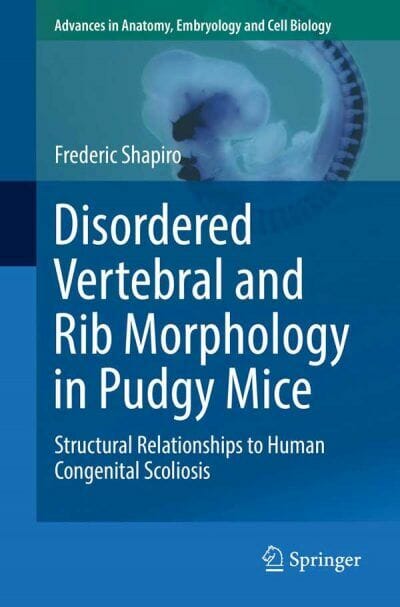 Disordered Vertebral and Rib Morphology in Pudgy Mice, Structural Relationships to Human Congenital Scoliosis