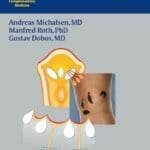 Medicinal Leech Therapy