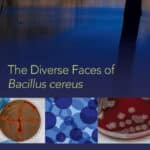 The Diverse Faces of Bacillus Cereus