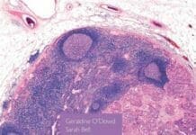 Wheater’s Pathology, A Text, Atlas and Review of Histopathology, 6th Edition PDF