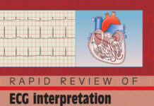 Rapid Review of ECG Interpretation in Small Animal Practice, 2nd Edition Rapid Review of ECG Interpretation in Small Animal Practice, 2nd Edition
